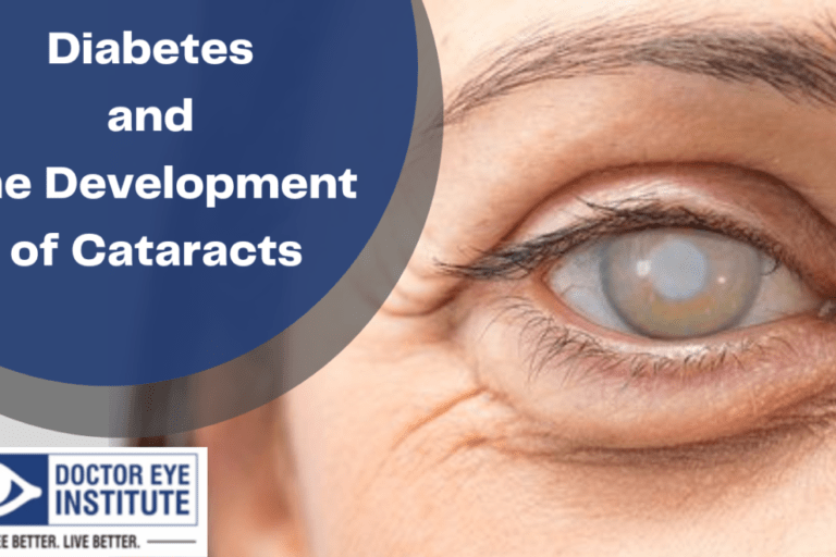 Diabetes and the Development of Cataracts | Doctor Eye Institute