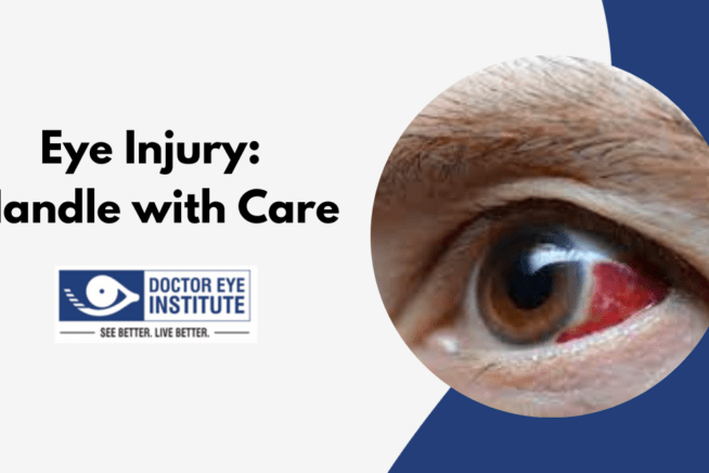 Eye Injury: Handle with Care | Doctor Eye Institute