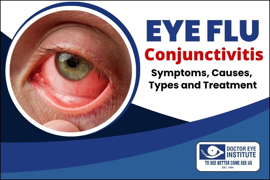Eye Flu (Conjunctivitis)