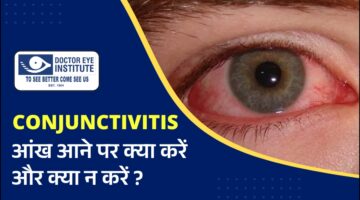 आंख आने पर क्या करें और क्या न करें?