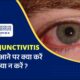 आंख आने पर क्या करें और क्या न करें?