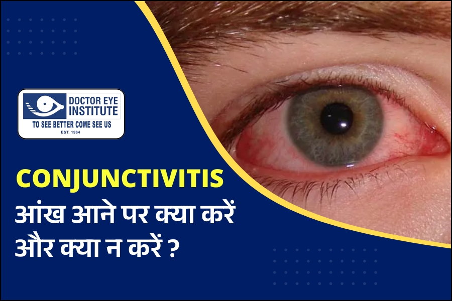 आंख आने पर क्या करें और क्या न करें?