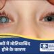 बच्चों में मोतियाबिंद होने के क्या कारण हैं?