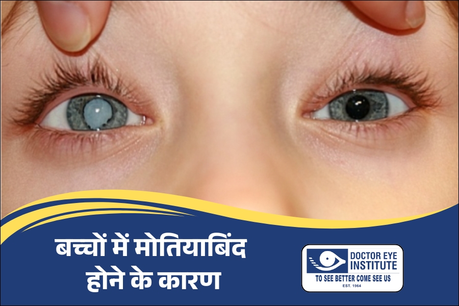 बच्चों में मोतियाबिंद होने के क्या कारण हैं?