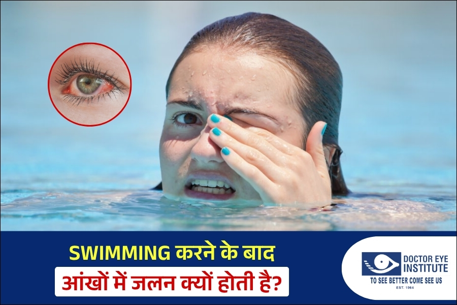 Swimming करने के बाद आंखों में जलन क्यों होती है?