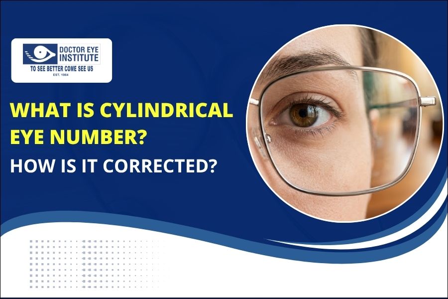 What is Cylindrical Eye Number and How Is It Corrected