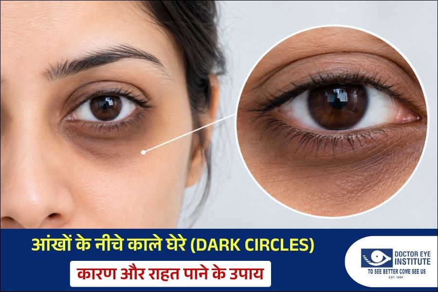 Dark Circles under the eyes